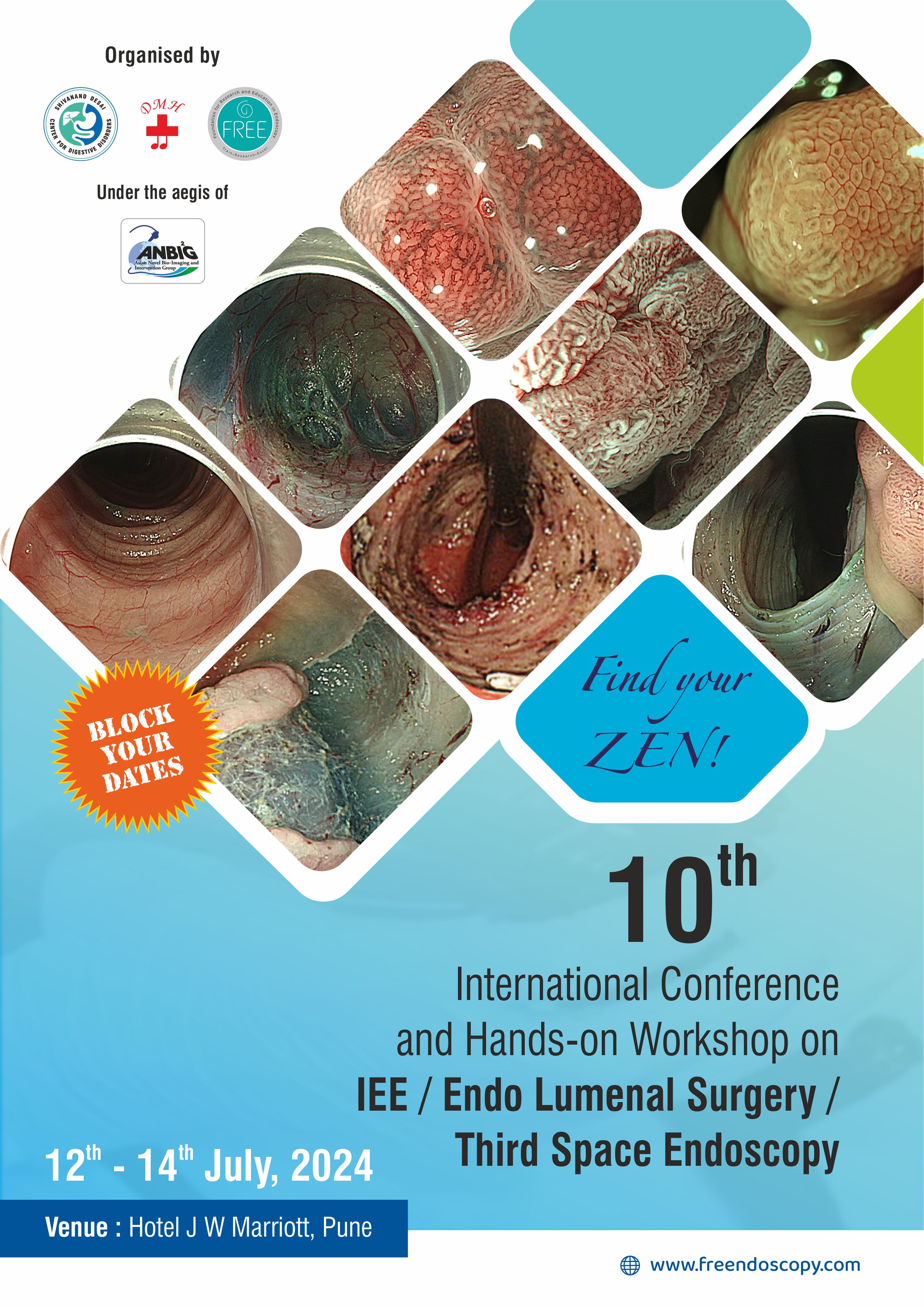 10th International Conference and Handson Workshop on IEE /Endo Lumenal Surgery Third Space Endoscopy Conference July 2024