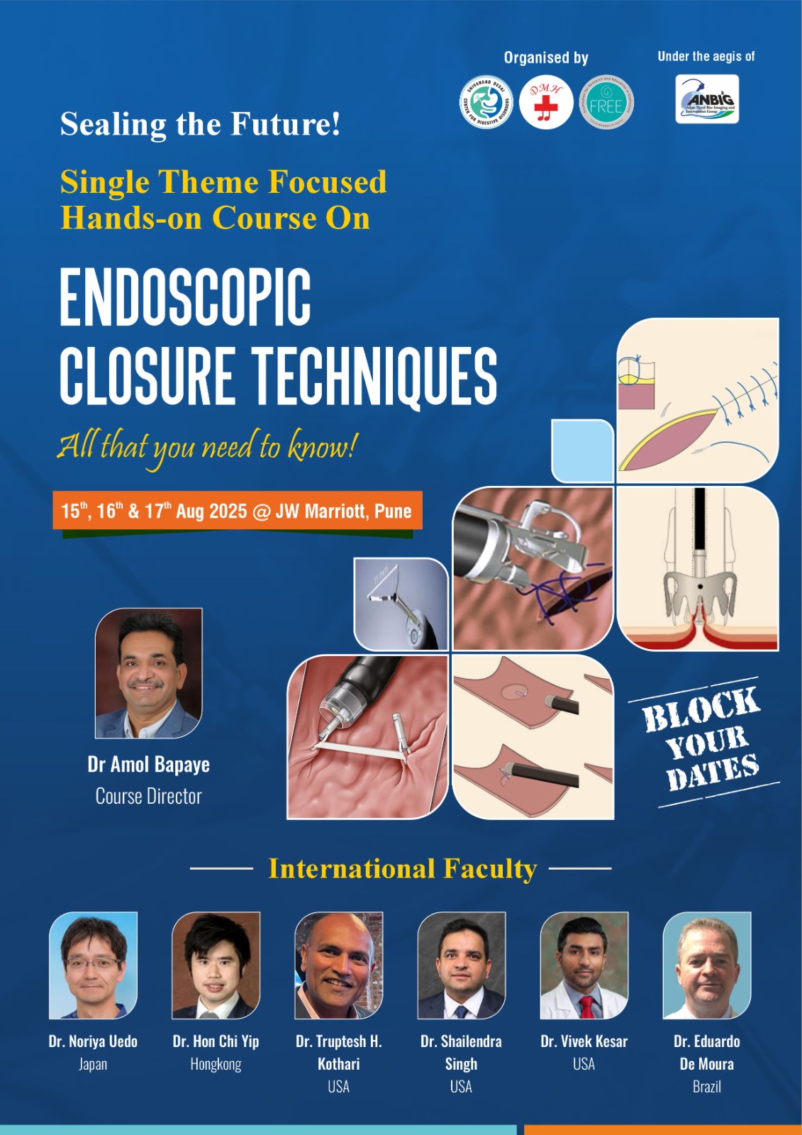 Endoscopic Closure Technique August-2025