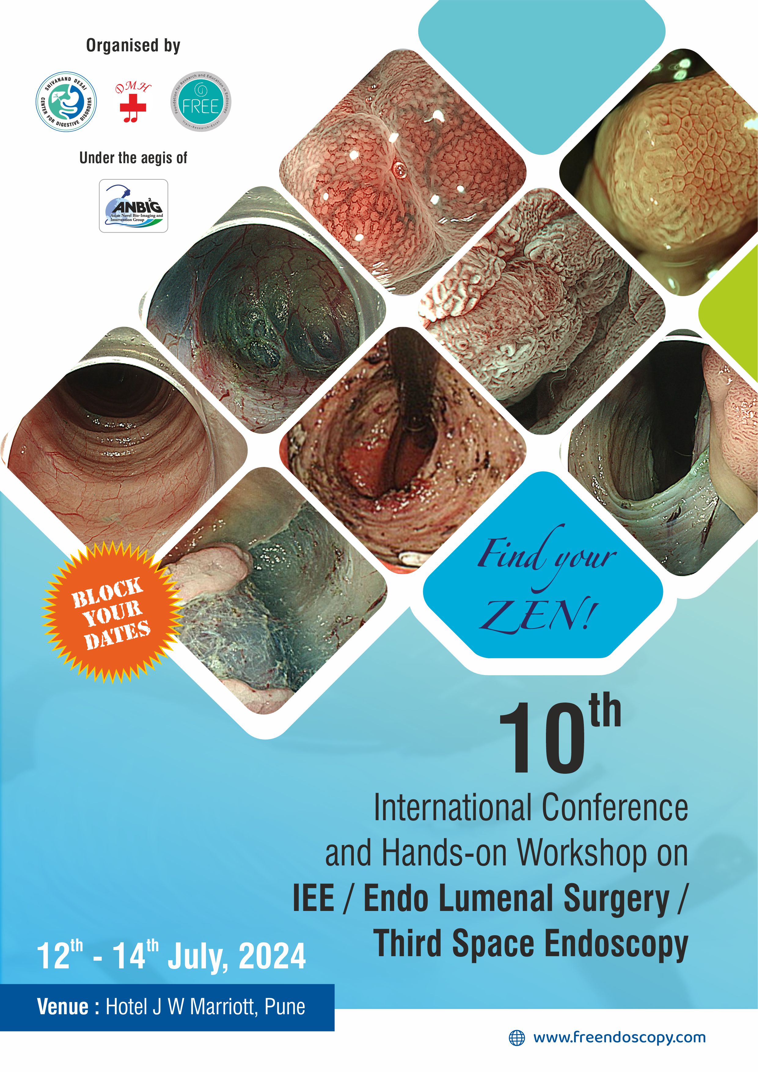 <p>10th International Conference and Handson Workshop on IEE /Endo Lumenal Surgery Third Space Endoscopy Conference July 2024</p>
