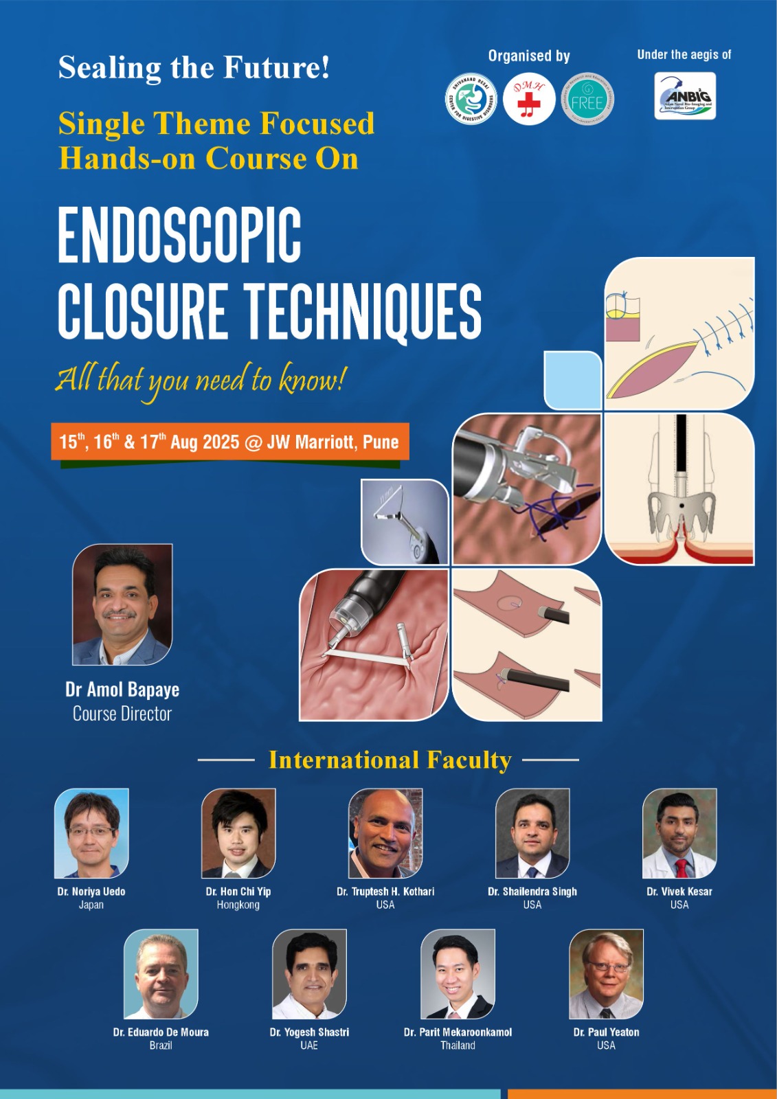 <p>Endoscopic Closure Techniques on August 15, 16 & 17th August 2025 Conference</p>
